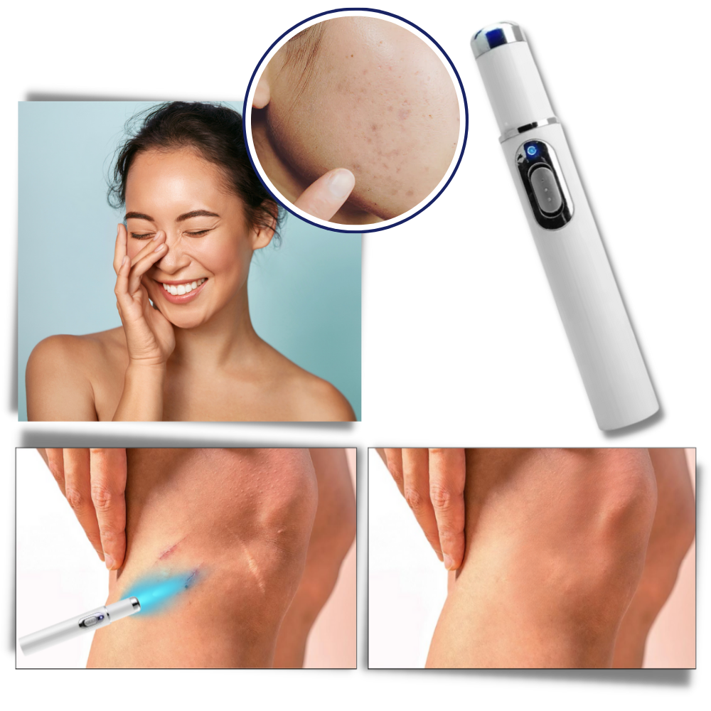 DermaPure | Thérapie laser portable pour un teint plus lumineux